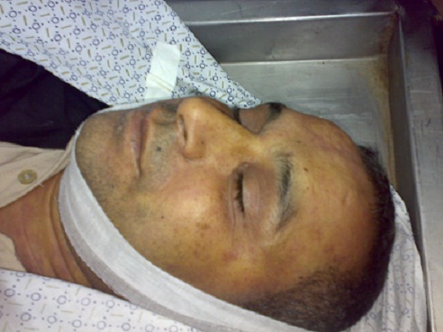 المواطن وائل أبو سعدة..  ضحية تشديد حصار غزة