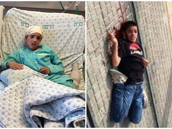 أحمد مناصرة.. الصورة تُكذب الاحتلال