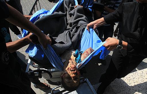 صورة استشهاد مؤمن الآضم 14عام وإصابة والده في حي الزيتون