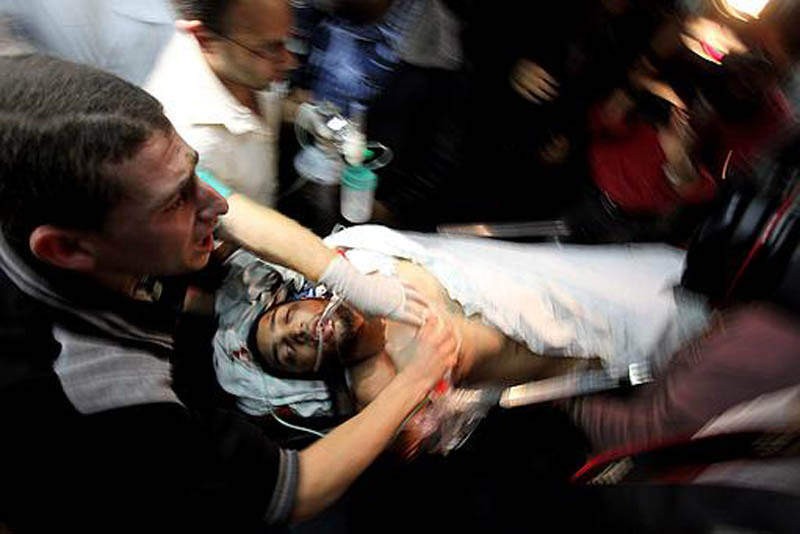 صور وصول أكثر من 30 مصاب إلى مستشفى الشفاء في غزة جراء قصف طائرات الاحتلال