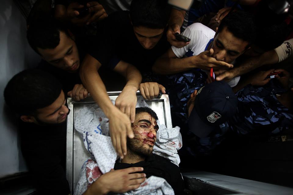 شهداء مخيم البريج في مستشفى شهداء الاقصى وسط قطاع غزة