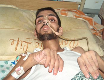 الصحة تحذر من نفاد 65 صنفًا من الأدوية و95 من المهمات الطبية