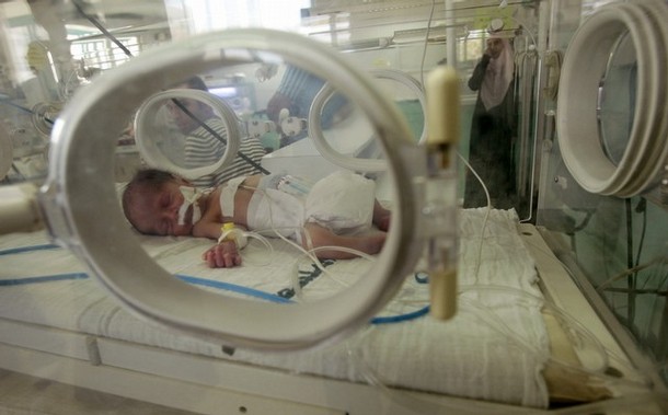 للمرة الأولى.. ولادة طفل من رحم امرأة ميتة بالبرازيل