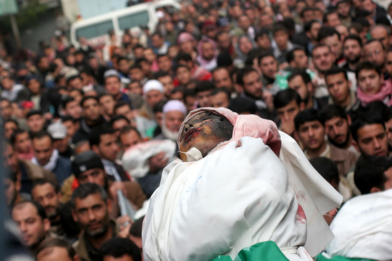 رائحة الموت والأشلاء المحترقة ولون الدماء والسواد المشهد العام في قطاع غزة